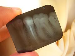 Brossage des dents : la règle des trois !