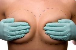Une tombola pour gagner une chirurgie mammaire en boîte de nuit chirurgie mammaire