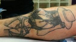 Incroyable : de la chirurgie plastique pour tatouages ! tatouage après