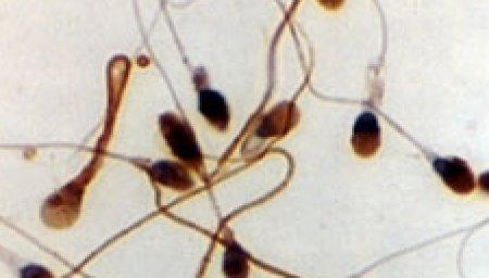 Pour les scientifiques, l'intelligence joue sur la qualit&eacute; du sperme