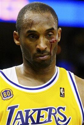 Upload: 24.03.08 Lakers @ Warriors