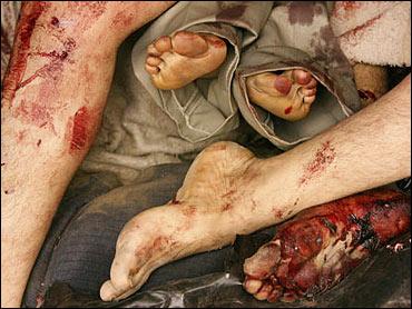 60e anniversaire de la charte des droits de l’homme… http://www.thewe.cc/thewei/&_/images8/iraq_image_/victims_of_us_attack.jpg