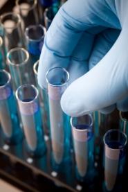 Bientôt un vaccin contre certaines infections nosocomiales ? éprouvettes