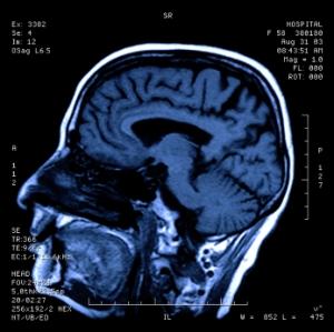 Des scientifiques découvrent une technique pour lire dans les pensées Cerveau