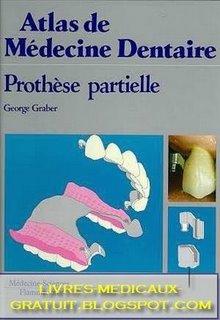 Atlas de Médecine Dentaire Prothèse Partielle