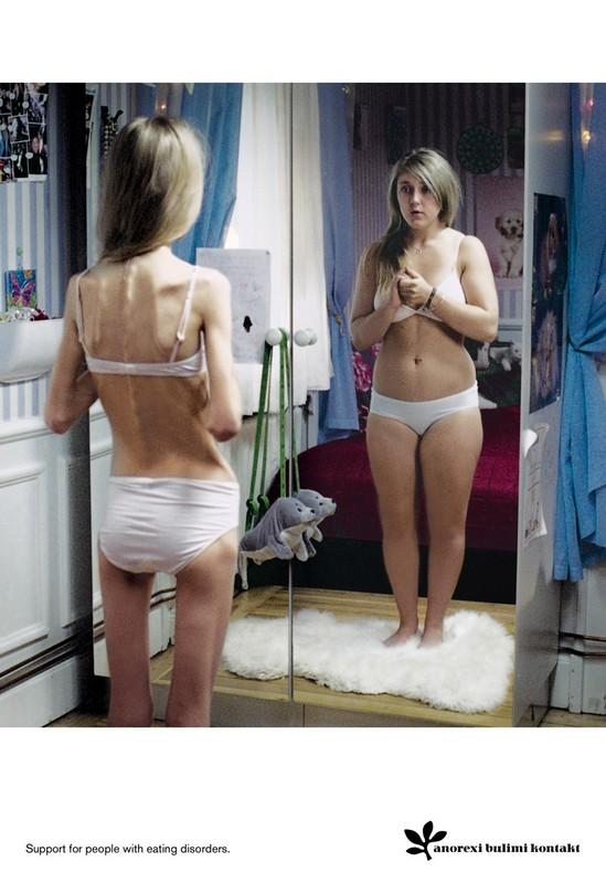 pub contre l’anorexie