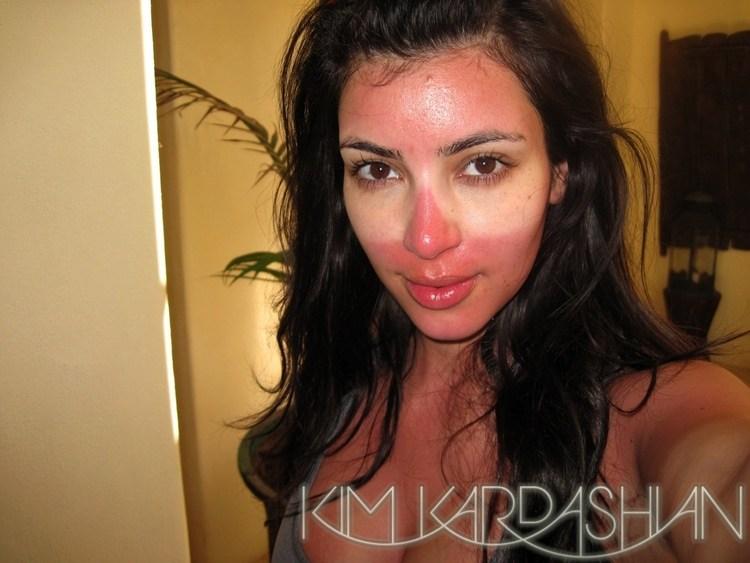 Kim Kardashian a pris un coup de soleil