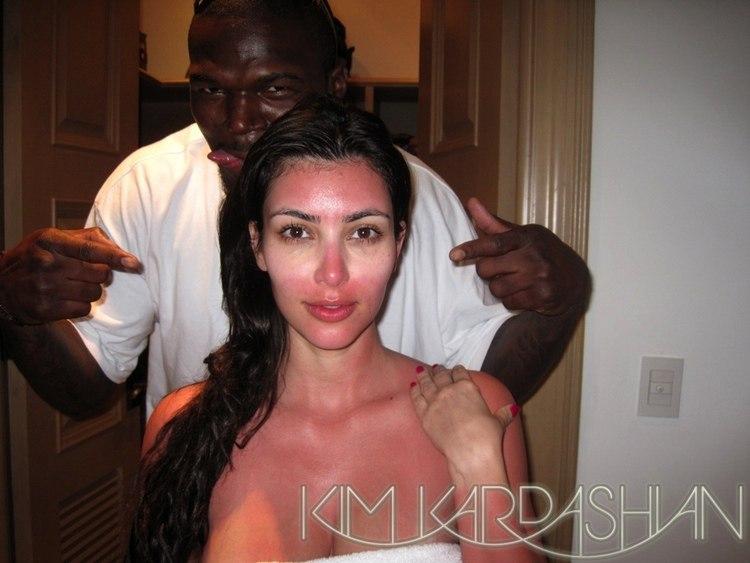 Kim Kardashian a pris un coup de soleil