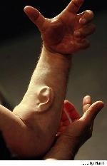 Il se fait implanter une oreille dans le bras ! une oreille dans le bras