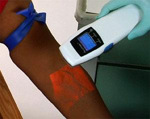 PRISES DE SANG SOUS INTRA-ROUGES PRISES DE SANG SOUS INTRA-ROUGES