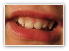 orthopédie dento-faciale et orthodontie