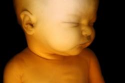 foetus