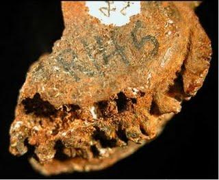 La plus ancienne infection humaine découverte sur d'anciens ossements La plus ancienne infection humaine découverte sur d'anciens ossements
