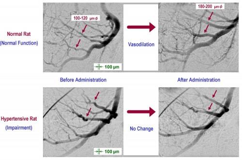 Traitements Acouphènes - Médicaments - Environnement Cellulaire - Vaso-Dilatateurs VasoDilat.jpg