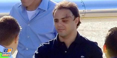 Massa accidenté et blessé 23 : Pas de retour avant 2010 ?