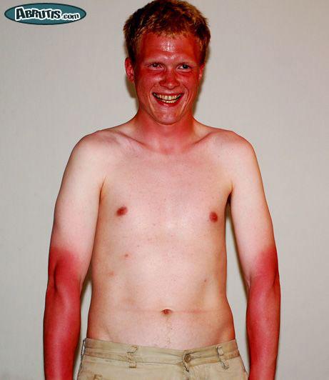 http://media.paperblog.fr/i/227/2270493/best-of-bronzages-moches-lete-L-10.jpeg