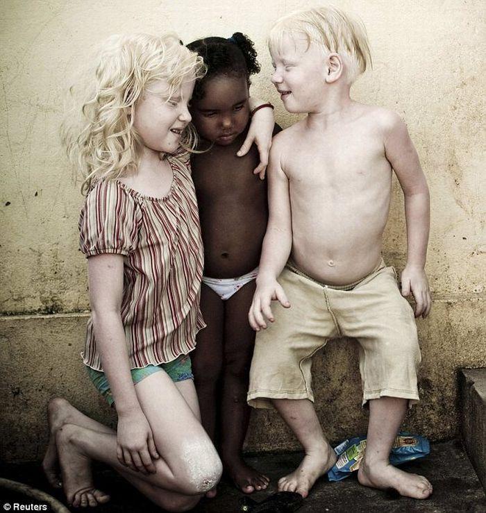 Trois albinos dans la même famille
