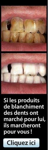 dents blanches
