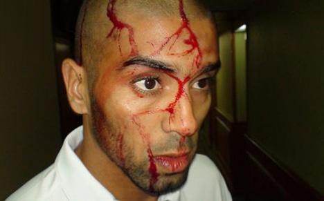 La FIFA a échoué 1589