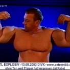 thumbs vicitime synthol021 Les victimes Synthol (53 photos)