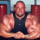 thumbs vicitime synthol030 Les victimes Synthol (53 photos)