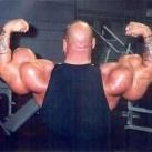 thumbs vicitime synthol031 Les victimes Synthol (53 photos)