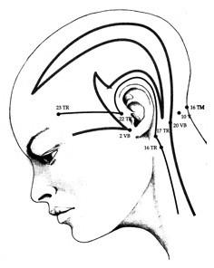 Acupuncture.jpg