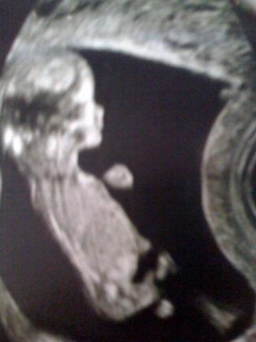 bebe2 Allez je vous le dis !