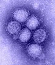 http://upload.wikimedia.org/wikipedia/commons/thumb/f/f0/H1N1_influenza_virus.jpg/180px-H1N1_influenza_virus.jpg