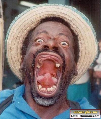 les dents !!! dent.jpg