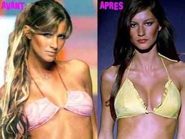 stars au naturel