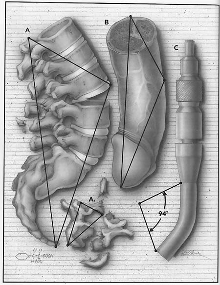 Organes coupés