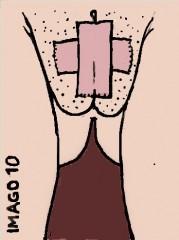 Epilation.jpg