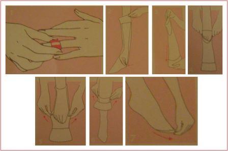 VeinOstim la compression qui donne le ton… shema_veinostim.jpg