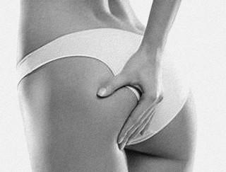 Pack anti-cellulite Karin Herzog , Déclarez la guerre aux capitons