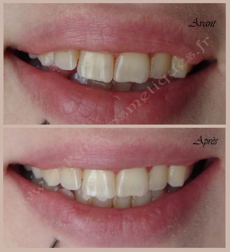 avantapresdents avantapresdents