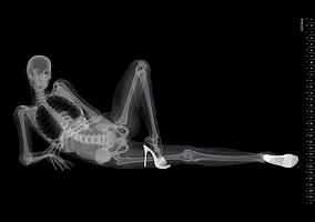 Calendrier pin-up x-ray
