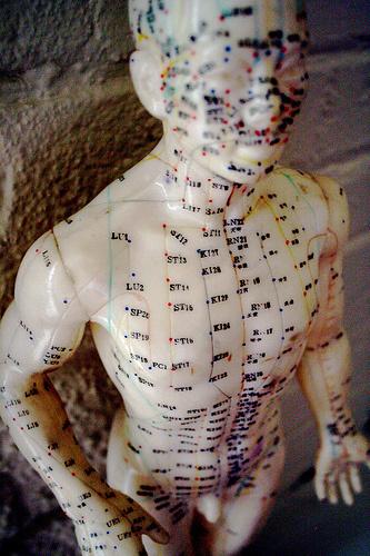 acu Les medecines alternatives aux US