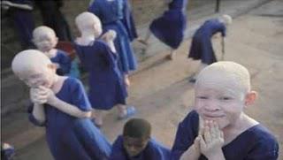 Le mercredi 25 août prochain : Journée de sensibilisation et de conscientisation des albinos Le mercredi 25 août prochain : Journée de sensibilisation et de conscientisation des albinos