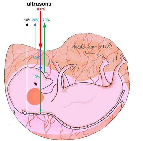 ultrasons foetus