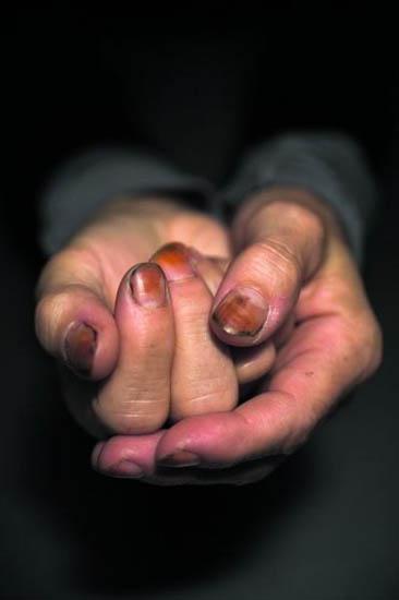 Koos Breukel / The hands of Sally Mann / 2008 / Source :...