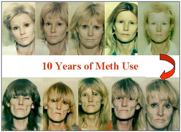 10 years of meth use