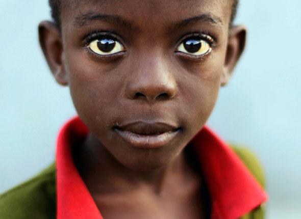 L'AFA évoque une réouverture des adoptions en Haïti...