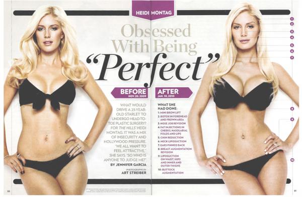 HEIDI-MONTAG-PLASTIC-SURGERY-PHOTOS La joke du jour!