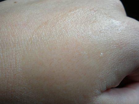 Le grand prix de ma 1ère allergie cosmétique est décerné : Le grand prix de ma 1ère allergie cosmétique est décerné :