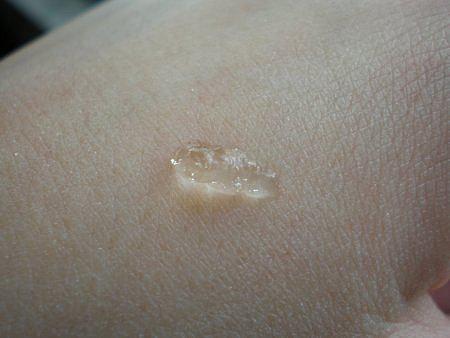 Le grand prix de ma 1ère allergie cosmétique est décerné : Le grand prix de ma 1ère allergie cosmétique est décerné :