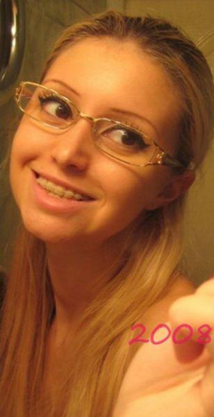 Chirurgie esthétique (FAIL) Chirurgie esthétique (FAIL)