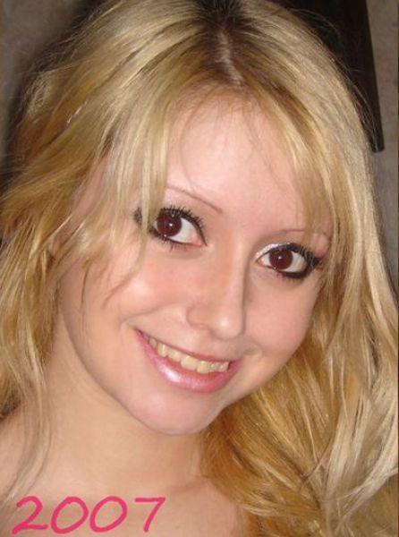 Chirurgie esthétique (FAIL) Chirurgie esthétique (FAIL)