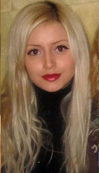 Chirurgie esthétique (FAIL) Chirurgie esthétique (FAIL)