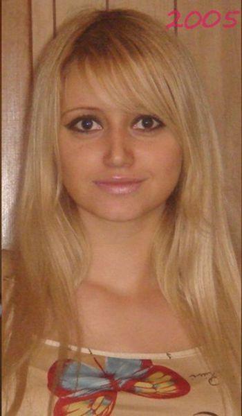 Chirurgie esthétique (FAIL) Chirurgie esthétique (FAIL)